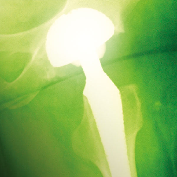 Nuffield Anniversary Brochure